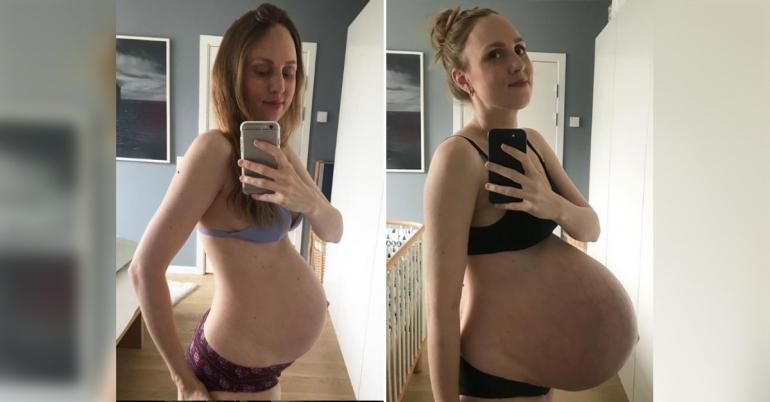 This is what having triplets does to your body (16 Photos)