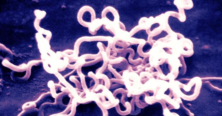 Syphilis Rises Sharply Among Newborns