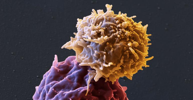 Breakthrough Leukemia Treatment Backfires in a Rare Case