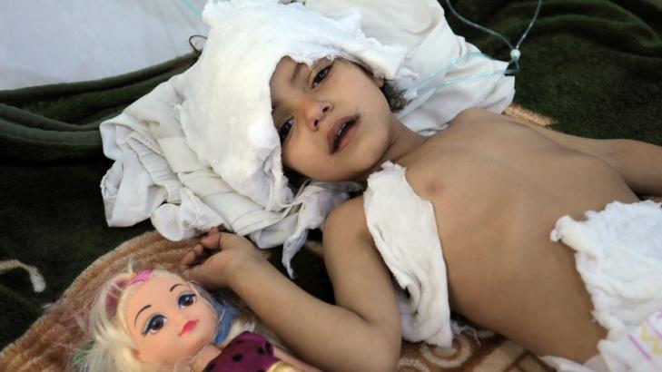 Slide Show: ‘Unthinkable... after Ethiopia’: Yemen faces globe’s worst famine in 100 years