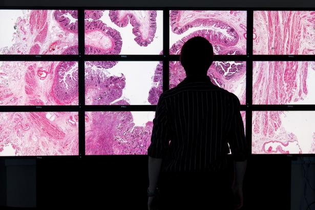 North receives £10m government investment for AI and digital pathology