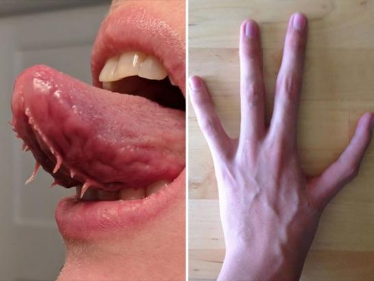 Body deformities that will leave you counting your digits (25 Photos)