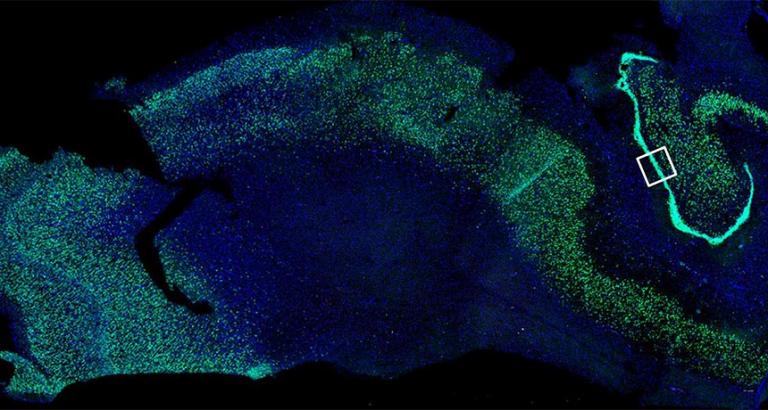 Signs of new nerve cells spotted in adult brains