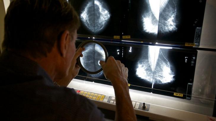 Menopause hormones causing breast cancer risks that may last decades