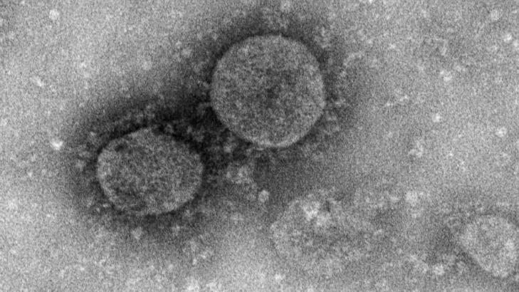 8th US case of coronavirus confirmed day after public health emergency declared