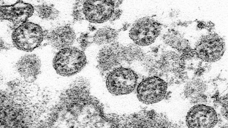 Serious coronavirus-linked condition hit 285 US children