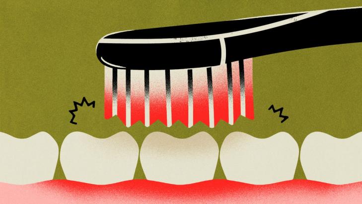 How to Know If You're Brushing Your Teeth Too Hard