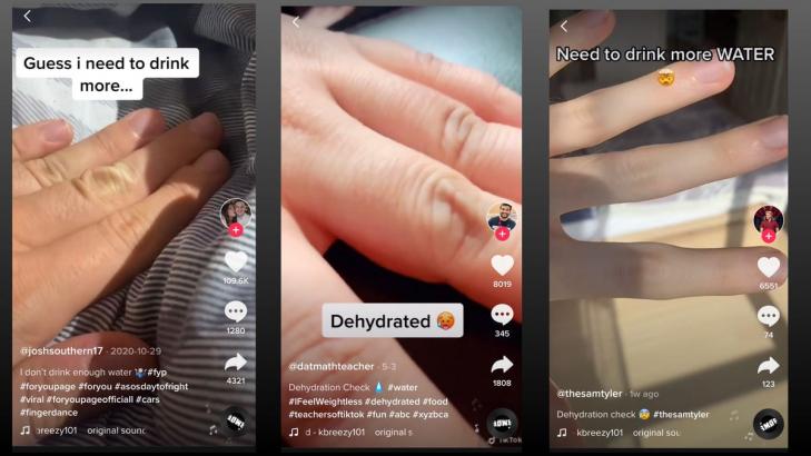 TikTok's 'Dehydration Check' Is Silly and Useless