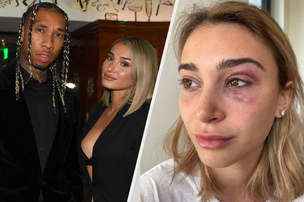 Tyga Was Just Booked For Domestic Violence After His Ex-Girlfriend Shared Photos Of Physical Abuse