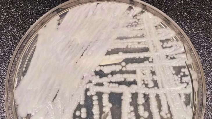 1st for Louisiana: Drug-resistant fungus found at hospital