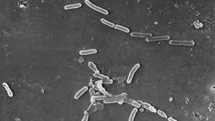 Study: Drug-resistant bacteria kill 1.2 million globally