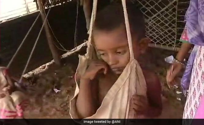 78,000 Children Found Malnourished From Jan To March: Madhya Pradesh Data